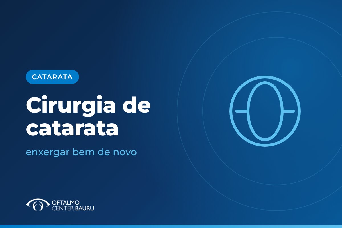Ilustração sobre cirurgia de catarata